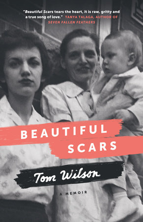 Beautiful Scars by Tom Wilson