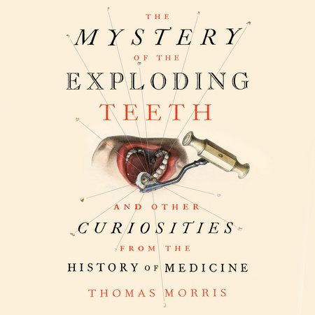 The Mystery of the Exploding Teeth by Thomas Morris